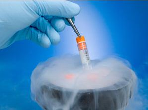 Cryopreservation-Vitrification