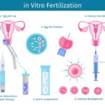 ivf-treatment-in-tamilnadu