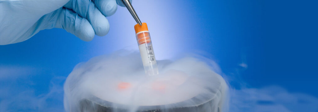 Cryopreservation-Vitrification